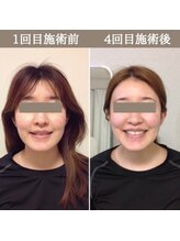 シェア 人形町店(Chare)/【小顔・骨盤矯正・О脚・整体】