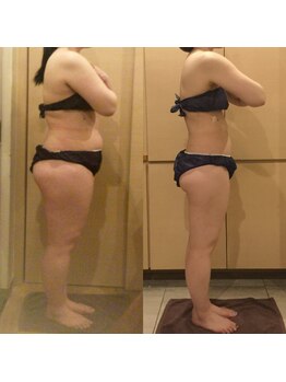 アユアランリンク 錦糸町店/L様：側面