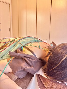 鍼灸整体院 はり処もりしーの森/☆電気の鍼(肩首や腰周り)
