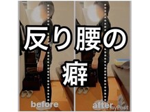 カワル整体 上通り院/反り腰の人の癖
