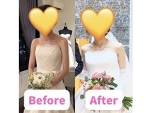 ボディキュア ブライダル美容整体 大阪梅田/胸が開いて自然に美しく◎/関西
