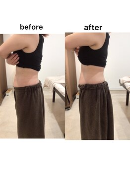 ジョワイユ(Joyeux)/腸の位置でお腹は変わる