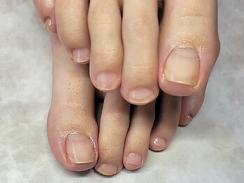 ハーツスタンダード(Hearts Standard)の写真/丁寧すぎる程のフットネイルケア＋足裏角質除去でふんわり柔らかかかとへ♪小指の爪が小さくお悩みの方にも