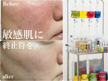 アリィ(Alii hisaya)