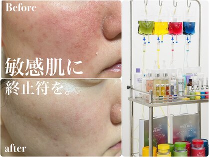 アリィ(Alii hisaya)の写真