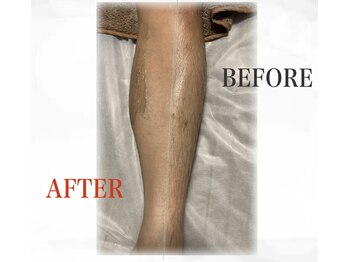 メンズブリリアンス/☆両ひざ下ＷＡＸ☆