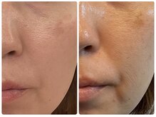 1回でここまで変わります