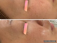 イディアル(IDE'AL)/ハーブ＋ローズセラム