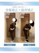 ヒナノ 矢場町店(HINANO)/骨盤矯正　経過