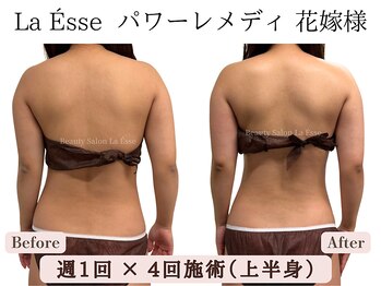 ラエッセ(La Esse)/式まで時間が無い方必見！