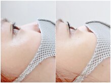 ロンロンビューティークリエイト(RONRON Beauty Create)/