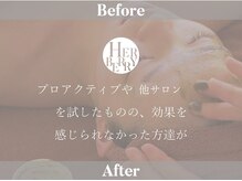 ハーバリー ハーブピーリング 大阪梅田店(HERBERRYハーブピーリング)/ボディハーブピーリングも大人気