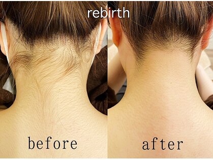 リバース(Rebirth)の写真