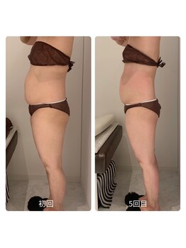 グッドライフエステ/Before＆Afterキャビ