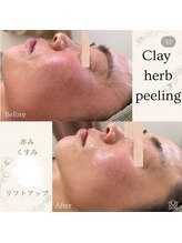 スリジエ ボーテ(cerisierBEAUTE)/赤ら顔,毛細血管拡張を緩和◎