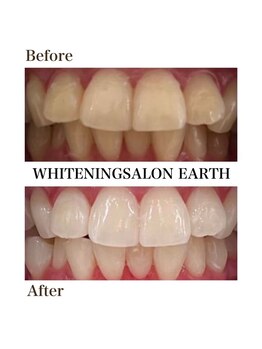 ルーナ 目黒(Luna)/見た目も明るく若返る