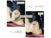 アンドエスビューティ(&S Beauty)の雰囲気（ワックス脱毛→VIO初回3980円・うなじ＆もみあげ☆ 4980円）