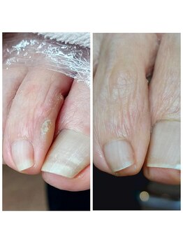 爪切り屋 足楽/