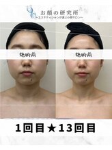 お顔の研究所/ビフォーアフター写真♪