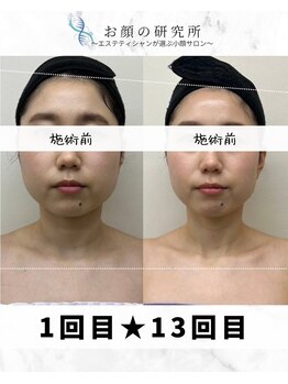 お顔の研究所/ビフォーアフター写真♪