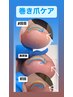 フット【ご新規様/巻き爪ケア2本+爪ケア/ネイルケア】