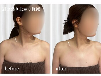 オトサロン(Otosalon)/整体★肩の盛り上がりスッキリ！