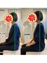 グレフル鍼灸接骨院 整体院 心斎橋/整体/肩こり/マッサージ/腰痛