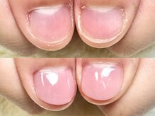 ココモ(cocomo)/(深爪/長さだし/フィルイン/)