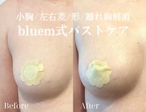 ブルーム(bluem)