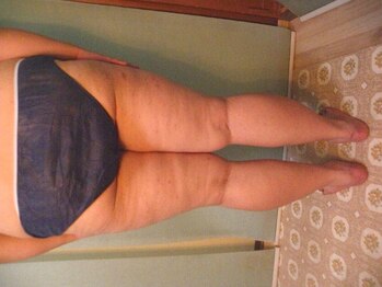 ビヒトジャパン 町田相模原/ビック ダイエット 痩身 エステ