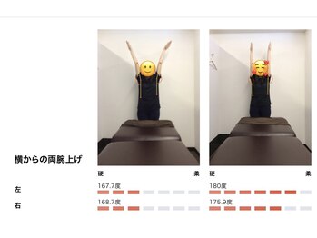 ベル/【20代】姿勢Before After