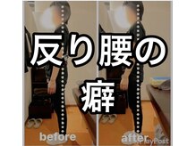 カワル整体 上通り院/反り腰の”癖”