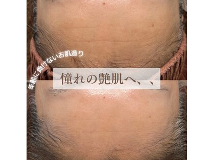 キキ(KIKI)の写真