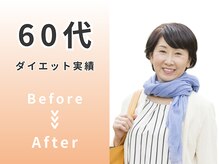 シーワイビー(C.Y.B)/60代 ダイエットBefore/After