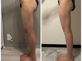 フュース(Futh)/1回の効果/下半身痩せ/むくみ