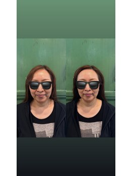 パボーネ(Pavone)/気になる小じわにアプローチ！