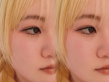 ヌン(nun)の写真/《フラットラッシュ×LED》圧倒的なボリュームと持続性！どの角度から見ても映える濃密なまつ毛に。