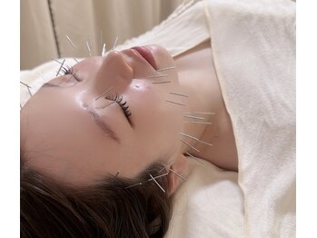クレラ 恵比寿(CLERA)/美容鍼