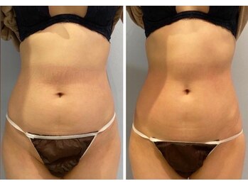 ルナグランデ(Luna grande.)/くびれ作りはルナグランデへ!