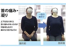 セルフケア整体 新宿店/実際のお客様◆1来店 首肩こり