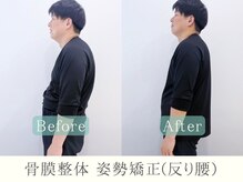 ヒラメント 亀戸院(Hilament)/反り腰改善〈整体〉