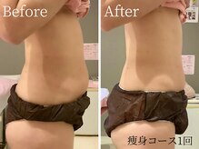 トータルエステティック ビューティスト 足利店(Total Easthetic Beautist)