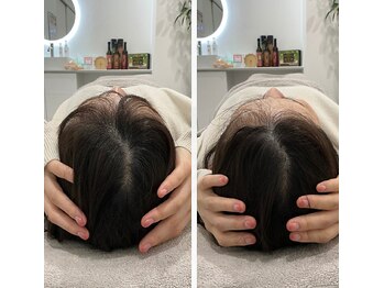 エール シガ(AILE SHIGA)の写真/【最新技術！「小顔矯正」がスゴい！】★当店人気No１!★今なら【小顔矯正+頭蓋骨矯正が¥11000→¥2980!】