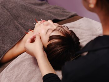 ビハリスト 新宿マルイ本館の写真/コスパと結果の両方重視の方必見♪小顔の速攻性と持続性の効果にこだわった美容鍼◎