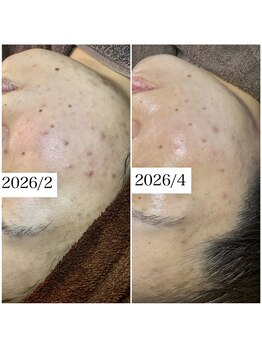 ブラックボックス(BLACK BOX)/30代女性のお客様