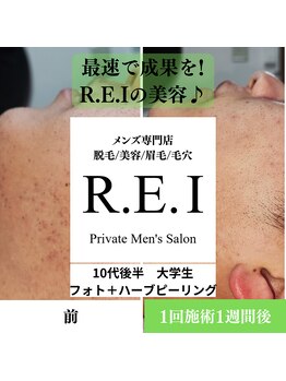 レイ(R.E.I)/10代後半／ニキビケア／1回