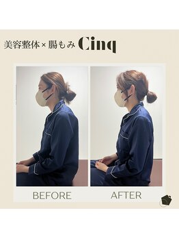 サンク(Cinq)/猫背整体と骨格矯正にて猫背改善