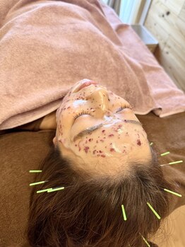 アルバ暁子鍼灸治療院(alba暁子鍼灸治療院)/マスク中の時間も無駄にしません