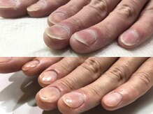 アリエ(allie)の雰囲気（男性も通える深爪矯正/再発させない深爪矯正/爪を育てる美爪再生）