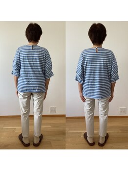 ランドル(rendre)/７０代女性　背骨弯曲、腰の張り